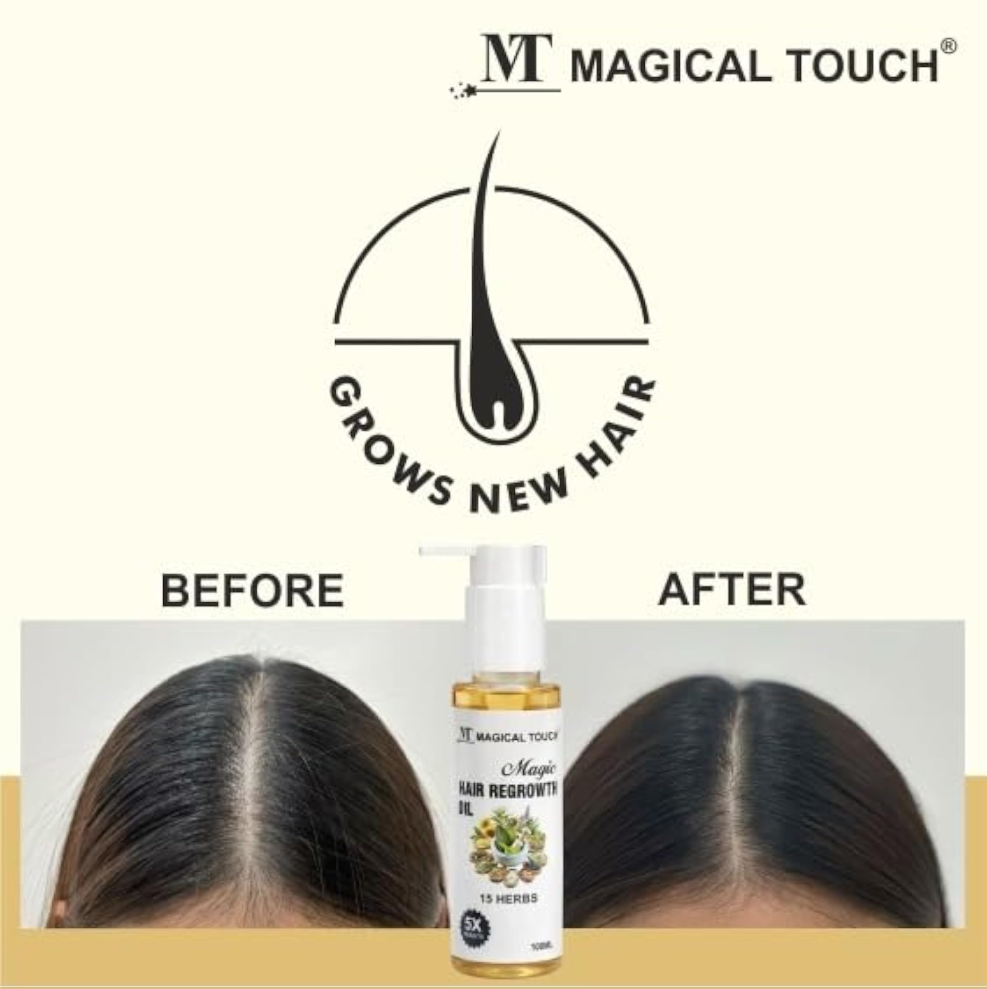 MAGIC Hair Regrowth Oil, Strengthens & Nourishes