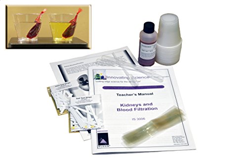 ALDON Innovating Science - Kidneys and Blood Filtration Kit