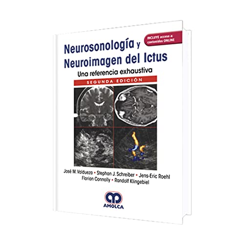 Neurosonología y Neuroimagen del Ictus. Una Referencia Exhaustiva + Ac