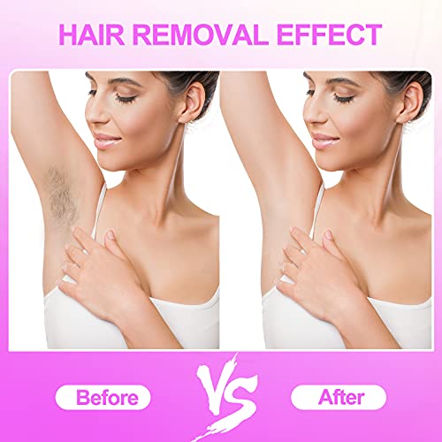 IPL Laser Hair Removal Device for Women and Men, 999,900 Flashes At-Home Permanent Painless Hair Remover for Facial Whole Body - Thumbnail 7