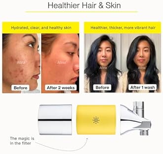 Afina Shower Filter – High Pressure Filtration for Healthier Hair & Skin, Reduces Hair Fall, Dry Itchy Skin, Dandruff, Eczema, Protects Colored Hair, Easy Install & Universal Fit, Chrome