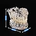 Ultrassist Transparent Disease Teeth Model with Dental Implant Bridge, Dental Model for Patient and Dental Student Education