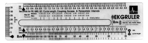 McCoy - EKG Ruler - -