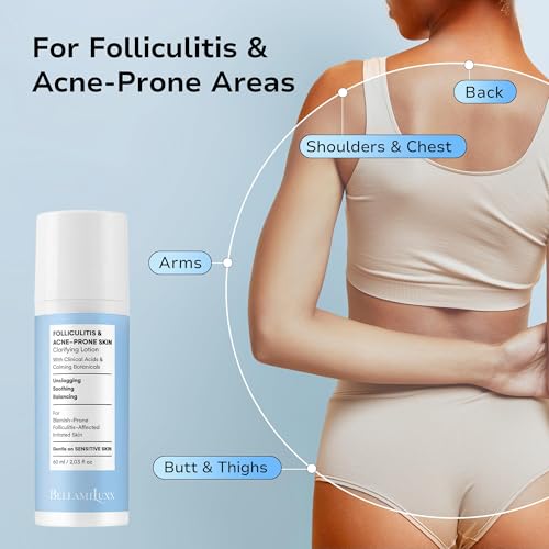 Image of BellamiLuxx Folliculitis Treatment Lotion for Body, Scalp, Face - Helps Reduce Body Acne, Itch, Redness & Bumps with Salicylic Acid & Glycolic Acid - Daily Care for Folliculitis-Prone Skin