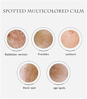 White Spot Cream China,White Spot Cream, Dark Spot Corrector for Face,Skin Care Facial Moisturizer Face Cream,White Spot Cream De China for Dry & Sensitive Skin