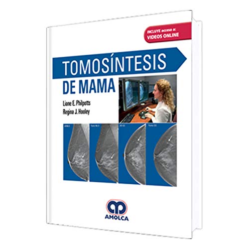 Tomosintesis de Mama + Videos Online