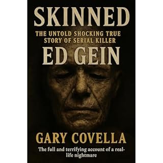 Skinned Audiobook By Gary Covella cover art