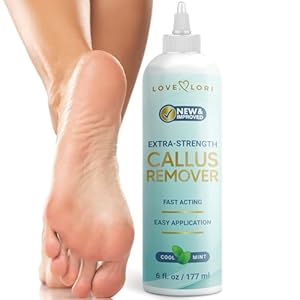 Callus Remover for Feet (Extra Strength) Foot Callus Remover Gel – Pedicure Tools for Feet Scrubber – Foot Care Spa Essentials, 6oz