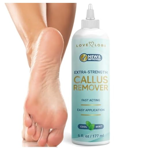 Foot Callus Remover Gel 6oz by Love, Lori - Callus Remover for Feet & Dead Skin Remover for Feet - Works with Foot Scrubber, Pumice Stone for Soft Feet - Professional Pedicure Results at Home