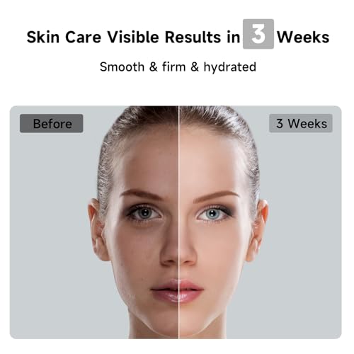 Image of JOVS Laser Hair Removal, 37F Painless Hair Removal Device with Sapphire Ice-Cooling, 3 in 1 Hair Removal & Skin Rejuvenation for Women and Men, 8 Modes Skin Care for Whole Body, Touch Screen, White
