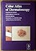 Produktbild Color Atlas of Dermatoscopy