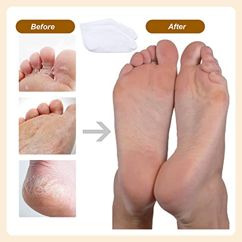 Scettar 7 Paar Feuchtigkeitsspendende Socken, Anti-Rutsch Fuß Spa Gel Socken Fußpflege Baumwollsocken für Frauen Männer Fußpflege für Hornhaut Entfernen, Trockene Rissige Füße (7 Weiß)