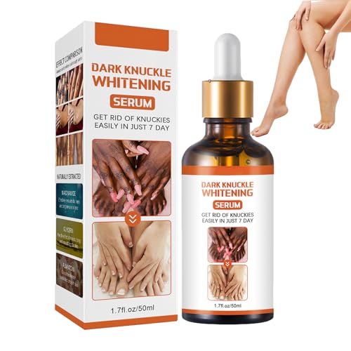Siero Sbiancante per Articolazioni,50ML Correttore Macchie Scure Siero Sbiancante,Siero Sbiancante per Il Corpo,Siero Sbiancante Nocche Scure Per Mani per Macchie Scure,Uniforma il Tono Della Pelle