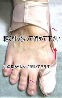 Amazon | 外反母趾予防サポーター ぼっち君 Lサイズ（25.5cm～28cm