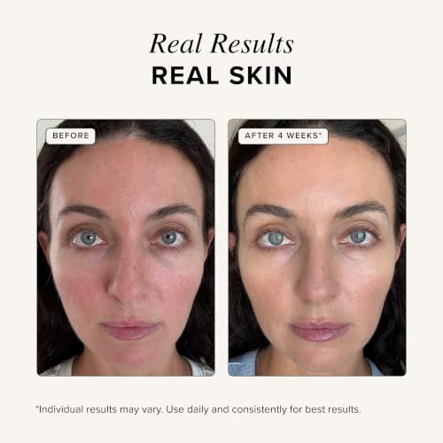 Asterwood Copper Peptides Serum for Face - with GHK-Cu Peptide and Hyaluronic Acid - Anti-Aging Facial Serum - 1 Fl Oz - Image 5