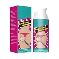 Hüftakne Creme,Butt Acne Cream,Akne-Entferner Am Gesäß,Akne-Reinigungscreme,Creme zur Entfernung von Mitessern Am Gesäß,Cremes zur Behandlung von Gluteekorn