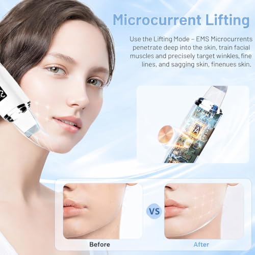Image of Docoss Facial Skin Scrubber & Ultrasonic Pore Cleaning Machine with 4 Modes, Blackhead Remover with Red Light & Blue Light, Face Cleansing Rechargeable Machine(White)