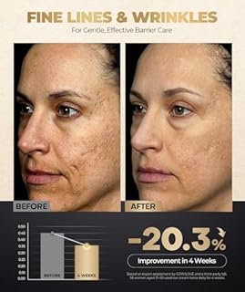 GOWILOVE 12Hr Moisture Lock Beef Tallow for Skin Care, Instant Redness Eraser Tallow and Honey Balm with 6 Botanical Rescue, Dewy Not Oily Face Cream Moisturizer Gift for Women Eczema Rosacea 3.04 Oz