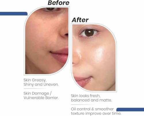 Immaculate Daily Oil-Free Face Moisturiser 100g - Image 6