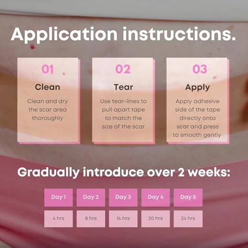 Image of Advanced Silicone Scar Sheets for Women, Medical grade silicone scar tape, Customized for Moms, Extra Long 1.6 inch x 60 inch, New Easy-Use Tear-Lines, Surgical Scars, C-Section, Tummy Tuck, Face Wrinkles