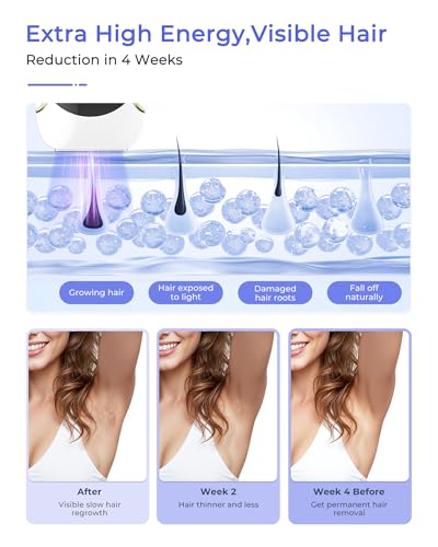 Laser Hair Removal for Women and Men, Air 15 Ice-cooling IPL Device Hair Removal for Nearly Painless & Long-Lasting Results From Home, 3 Modes & Auto Flashing for Fast Full Body Hair Removal - Image 4