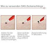Qaziuy Zeckenschlinge, Zeckenschlinge Hund mit Lupe, Schnelle Zeckenentfernung Zeckenzange für Hund, Katzen, Mensch