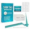 Gidenfly Origineel Micro Skin-Tag-Remover apparaat voor kleine/middelgrote huidtags (bevat 10x reiniging katoenen platen…