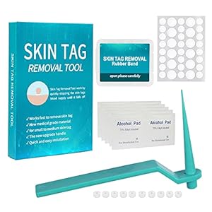 Gidenfly Origineel Micro Skin-Tag-Remover apparaat voor kleine/middelgrote huidtags (bevat 10x reiniging katoenen platen…