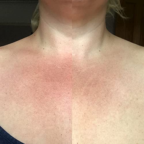 My Instant Effects Neck And Chest Rejuvenating Serum For Women - Helps Hydrate And Revive Your Skin - Very Quickly Brightens Beautiful Skin - Helps Speed Up Skin Renewal - 1 Oz #TOP2