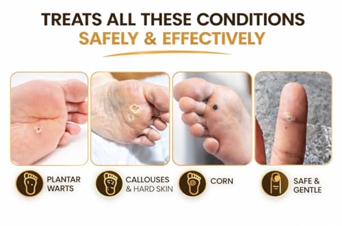 Image of Dr Sudhir's Famous Foot Corn /Callus /Wart Remover