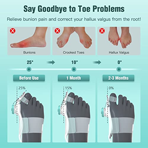 Tenicore Bunion Corrector For Women Big Toe, Orthopedic Toe Straighteners For Men, Adjustable Bunion Splint For Bunion Relief With Knob Correction, Inner Silicone Pad And Anti-Slip Heel Strap(1Pc) #TOP1