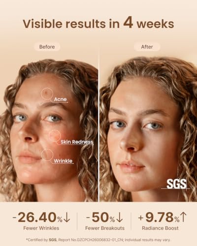 RENPHO Red Light Therapy Mask for Face, FDA-Cleared,Birthday Gifts for Wife - Image 2