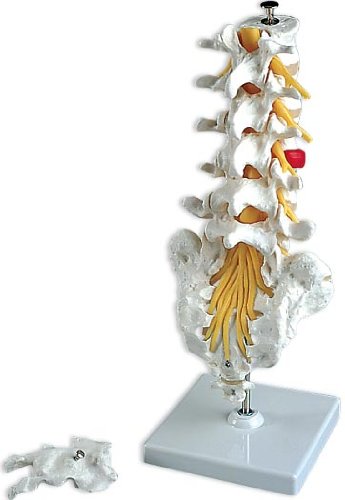 Amazon | 3B社 腰椎模型 腰椎モデル（ヘルニア付） (a76-5) | 3B社
