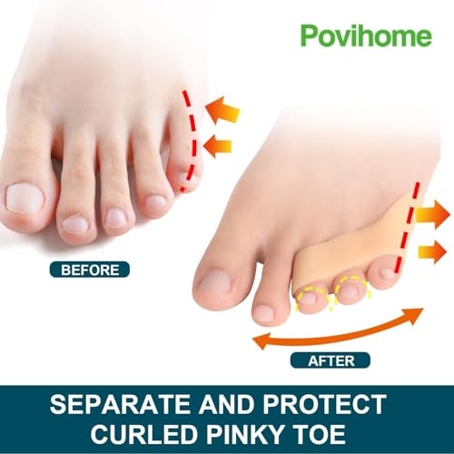 Image of Toe Separator for Feet Toe Spacers Correct Toes Yoga Silicone Hammer Toe Corrector for Women & Men Correct Toe Straighteners for Overlapping Toes (L F t separator)