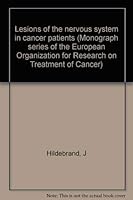 Lesions of the nervous system in cancer patients (Monograph series of the European Organization for Research on Treatment of Cancer ; v. 5) 0890042691 Book Cover