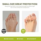 Zoom IMG-1 bukihome toe separators bunion corrector Zoom IMG-1 bukihome toe separators bunion corrector