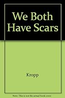We Both Have Scars 0029539846 Book Cover