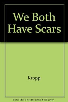 Paperback We Both Have Scars Book