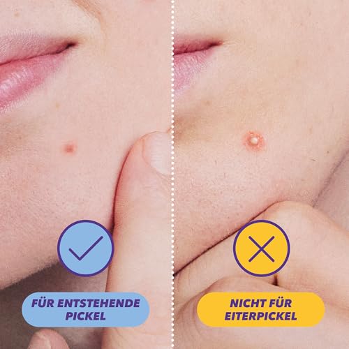 BENZACARE Anti-Pickel Power Patches, 36 Stück, Reduziert Pickel in 4 Stunden, Unischtbare Patches mit Salicylsäure und Centella, Reduziert & schützt Pickel und lindert Rötungen und Entzündungen