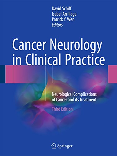 Cancer Neurology in Clinical Practice: Neurological Complications of Cancer and its Treatment (English Edition)