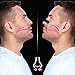 Nozibye Nasal Strips, Nose Strips for Breathing - 24 Strips
