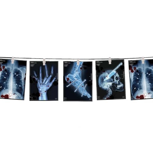 Girlande Halloween-Röntgenbilder, 3m – Miniatur
