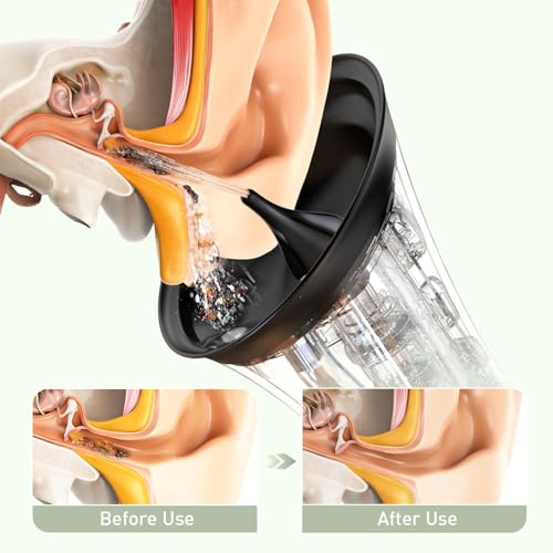 Image of Ear Wax Removal - Electric Ear Cleaner with IPX7, Water Powered Ear Cleaning Tool with Irrigation Flusher, 6 Tips, 4 Pressure Settings - Safe & Effective for Ear Wax Cleaning Gifts for Women Men