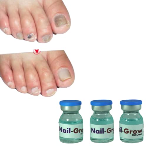 Nail growth oil | Pedicure kit | Cuticle oil for nails | Nail care | Nail strong growth oil | strong growth