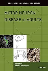 Amazon.co.jp: Plum and Posner's Diagnosis and Treatment of Stupor