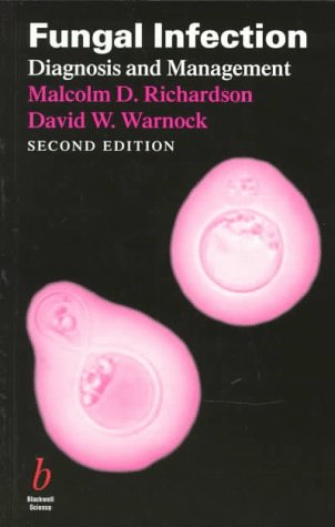 Fungal Infection: Diagnosis and Management: Richardson, Malcolm D ...