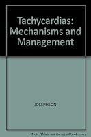 Ventricular Tachycardia: Mechanisms and Management 0879931817 Book Cover