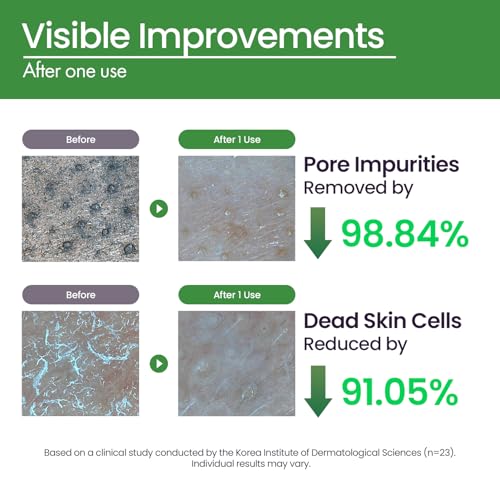 Image of Papa Recipe Tea Tree Control Enzyme Powder Cleanser (1.7oz /50g) - Travel-Friendly Korean Powder-to-Foam Face Wash, Soothing & Calming Care, Gentle Exfoliation, Smooth Texture & Pore Care
