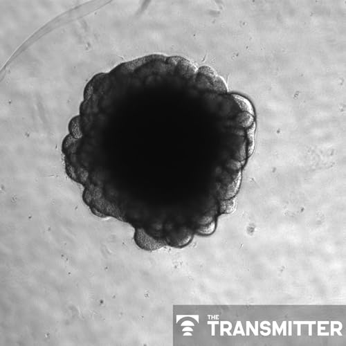 Viral remnant in chimpanzees silences brain gene humans still use