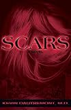 Scars